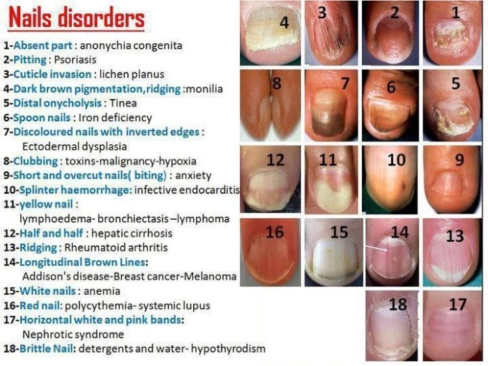 Chapter 10 nail disorders and diseases