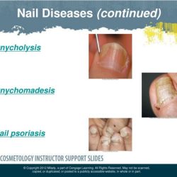 Worksheet disease symptoms ks3 microbes microbe causing tes different does why look resource