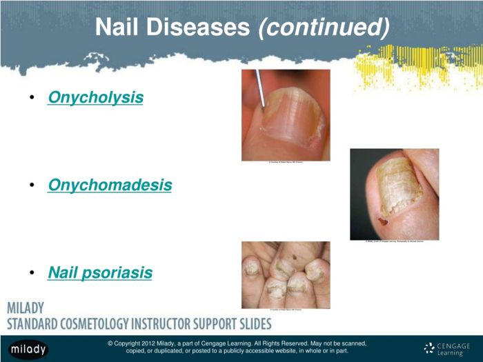 Worksheet disease symptoms ks3 microbes microbe causing tes different does why look resource